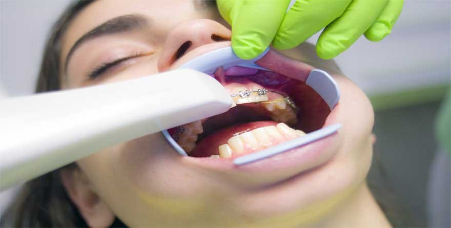 Risks of Poor Oral Hygiene