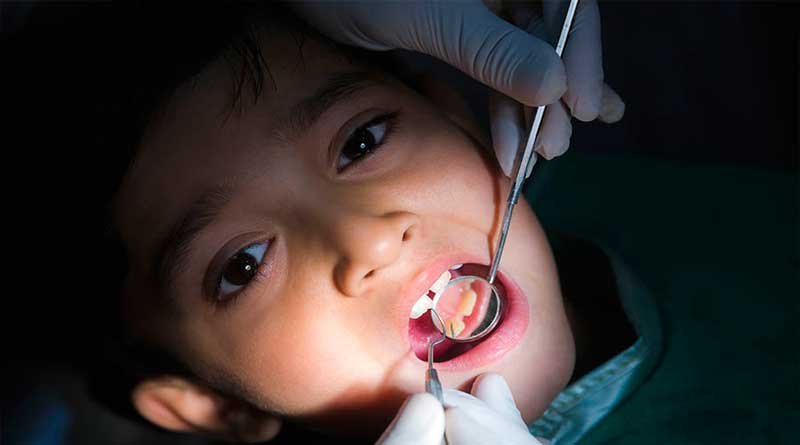 Five Questions for Best Dental Care